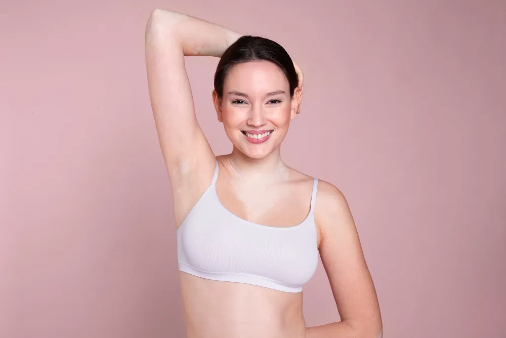 Underarm Botox for hyperhidrosis